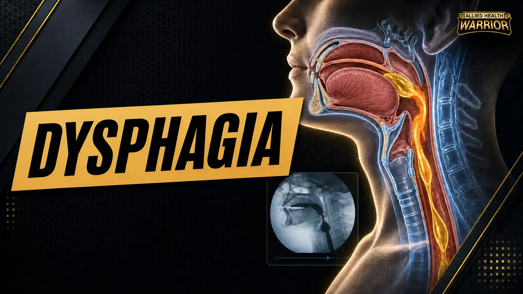 Dysphagia